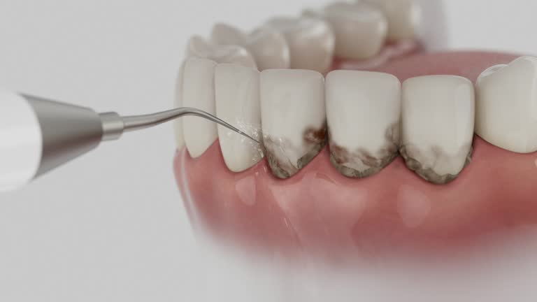 Reliable Tooth Extraction contractor in Clarksville, TN by Smile Center Dentistry